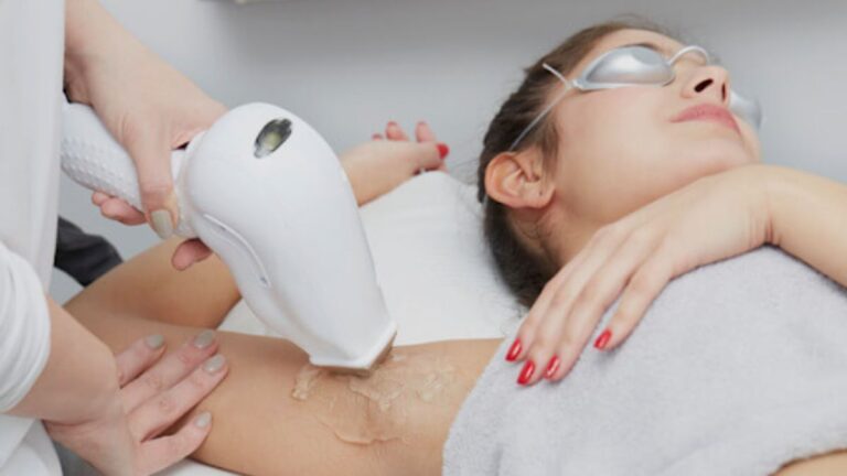 Laser Hair Removal